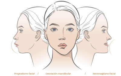 ¡Sonríe con confianza: Descubre los alineadores dentales Smartee!