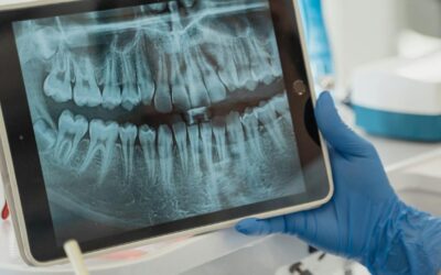 Revolución para el Paciente con Smartee en la Ortodoncia